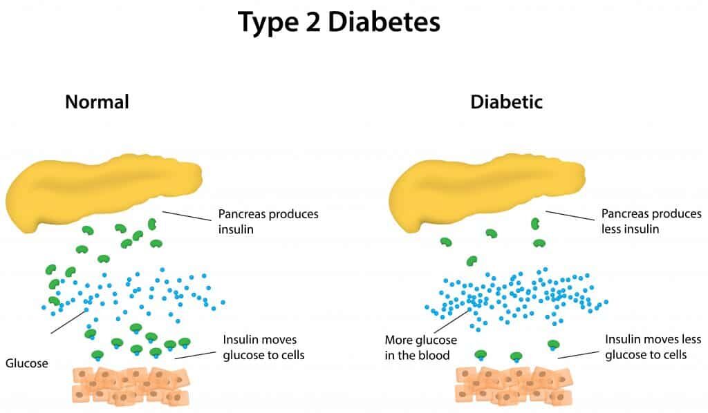 Glucose Disposal Agents